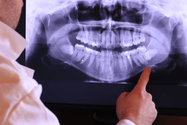 Best Emergency TMJ Treatment in San Benito, TX