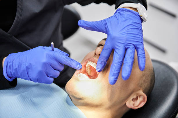 Best Emergency Gum Treatment in San Benito, TX